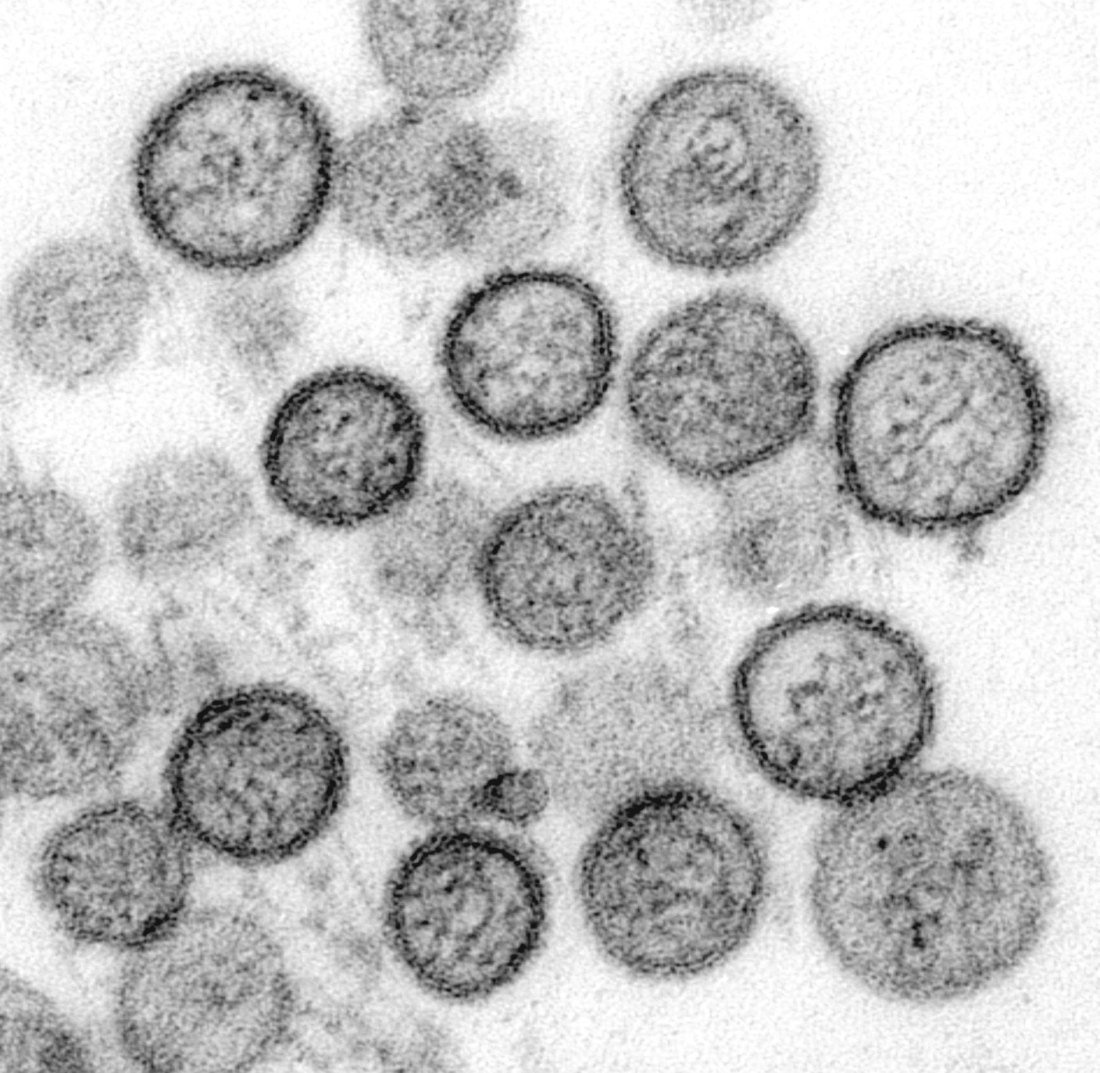 Ship Hantavirus Outbreak Ends