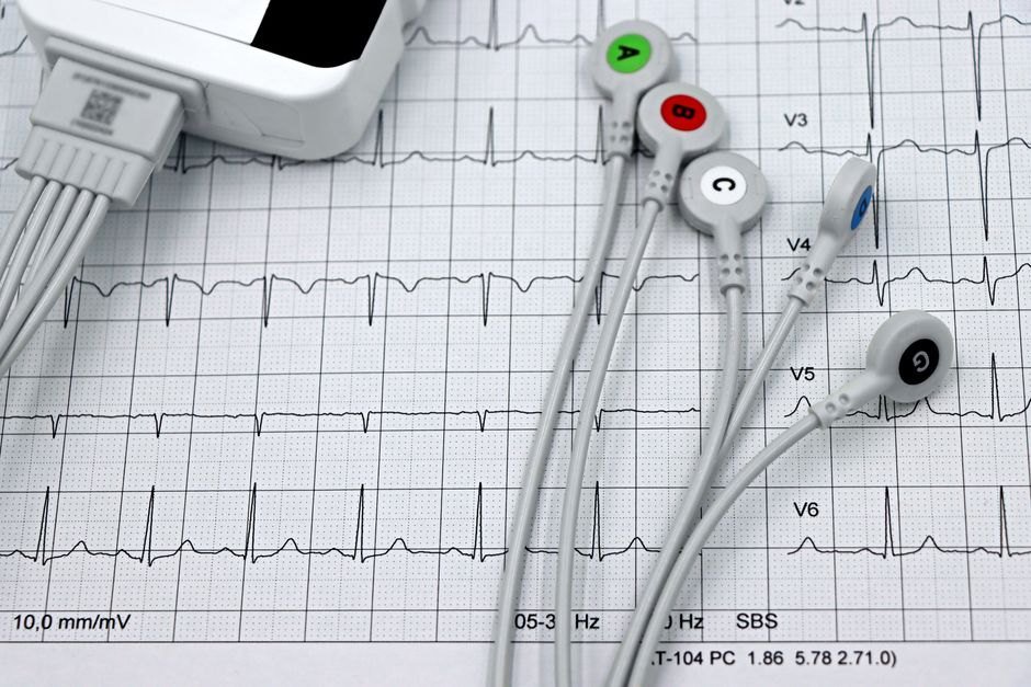 New AI Technology Helps Doctors Check Heart Health